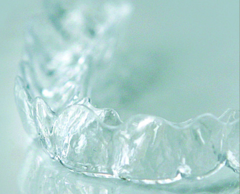 aesthetic liner® - transparente Zahnkorrekturschiene